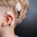 The Complete Guide to Hearing Implants: Types and Considerations