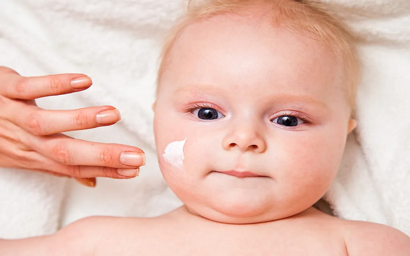 your baby's dry skin